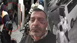 Sosyal medya fenomeni boşanma aşamasındaki eşi ve ailesi tarafından böyle darp edildi